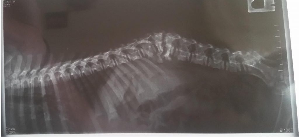 Spine Fracture Radiography 1